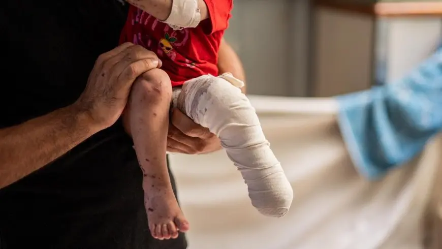 صحة غزة: 4500 حالة بتر بينهم 800 طفل و540 سيدة في القطاع