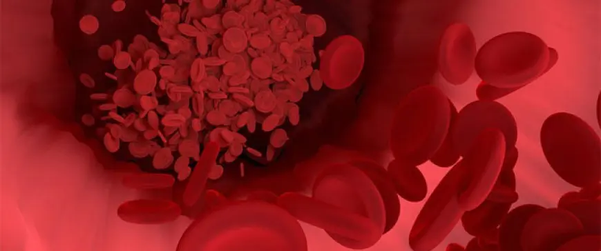 الأنيميا الخبيثة.. خلل فيتامين ب 12 الذي يُشخَّص خطأ بنقص الحديد