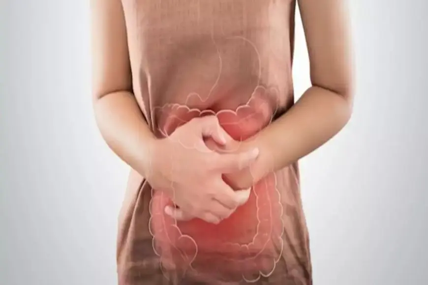6 أطعمة تدعم صحة الأمعاء- تناولها