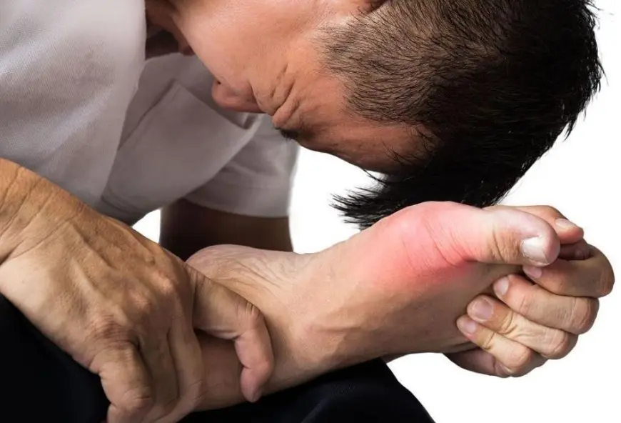 بعد عيد الأضحى.. كيف تحمي نفسك من آلالام النقرس؟