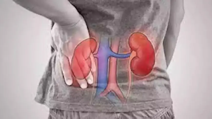 طريقك المباشر للفشل الكلوي.. احذر طعام شائع يعشقه ملايين