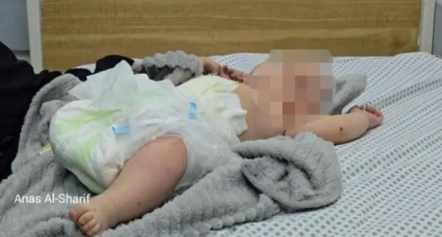 قصف إسرائيلي يبتر قدم رضيع بغزة ويشوه جسده.. ووالدته تناشد العالم لإنقاذه