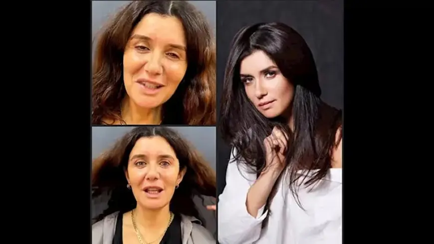 بالفيديو والصور.. غادة عادل قبل وبعد عملية تجميل “شد الوجه”