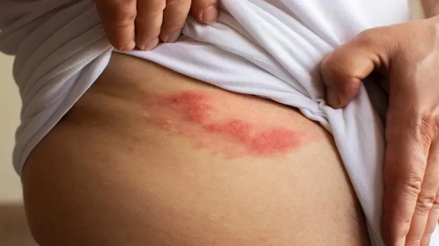 يعطي بداية من 18 سنة.. ما هو تطعيم الحزام الناري؟