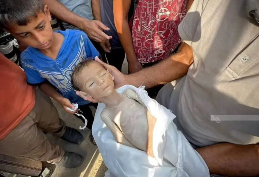 شهداء الجوع في غزة.. ارتفاع عدد وفيات المجاعة وسوء التغذية إلى 101 حالة بينهم 80 طفلا