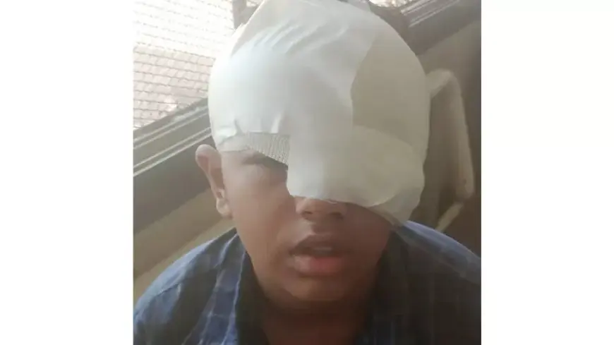 “أنا وشي باظ”.. حكاية الطفل “معاذ” تنمر عليه زميله وشوه وجهه بـ”موس” في عزبة مدكور