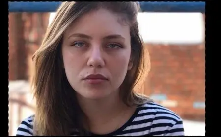 رحمة حسن تعلن إصابتها بالصلع بعد خطأ طبي: استخدموا المينوكسيديل من غير إذني