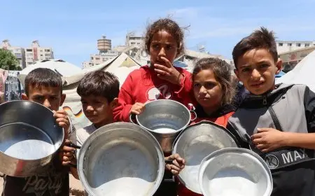 تسجيل 5 وفيات جديدة بسبب سوء التغذية في غزة وسط تحذيرات من أزمة إنسانية متفاقمة