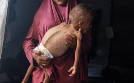 شهداء الجوع في غزة.. تسجيل 8 وفيات جديدة نتيجة المجاعة وسوء التغذية