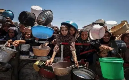 ارتفاع عدد وفيات سوء التغذية في غزة إلى 193