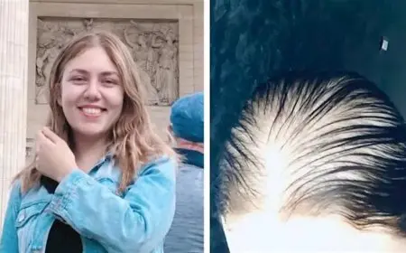 بعد سقوط شعرها وإصابتها بالصلع.. رحمة حسن: “إحنا مش فئران تجارب”