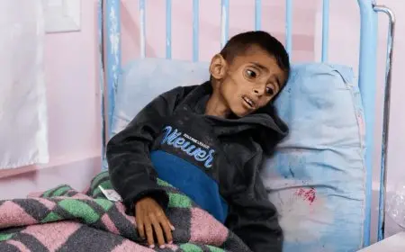 نتيجة الحرب والتجويع.. متلازمة غيلان باريه تفتك بأطفال غزة