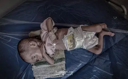 صحة غزة تعلن تسجيل 4 وفيات جديدة نتيجة المجاعة وسوء التغذية