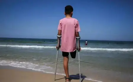 مبتورو الأطراف في غزة.. محرومون من العلاج والتأهيل والسفر