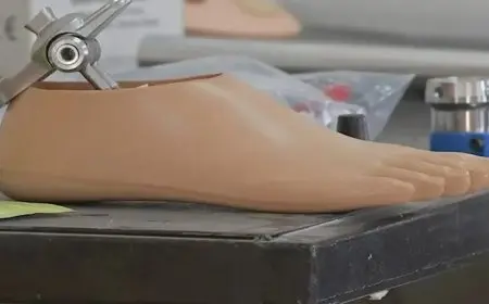 من وسط الركام.. فلسطيني يصنع طرفًا صناعيًا من “ماسورة مجاري” بعد بتر قدمه