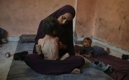 شهداء الجوع في غزة.. 5 وفيات بينهم طفلان نتيجة المجاعة وسوء التغذية