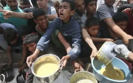 ارتفاع إجمالي ضحايا المجاعة وسوء التغذية في غزة إلى 239 منهم 106 أطفال