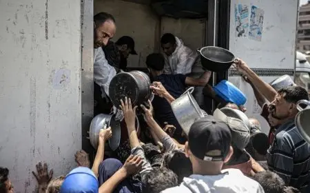 شهداء الجوع في غزة.. وفاة طفلة غزاوية في إيطاليا بعد يومين فقط من وصولها لتلقي العلاج