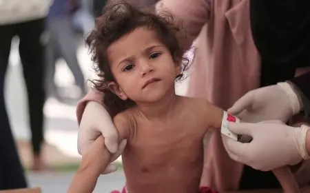 اليونيسف: 112 طفلا يدخلون دائرة سوء التغذية يوميا في قطاع غزة