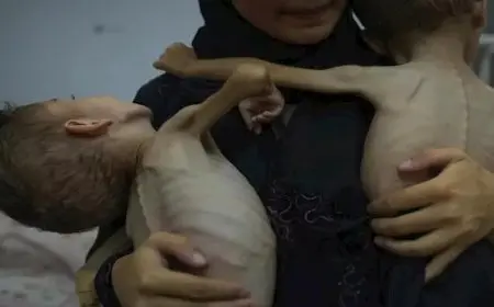 الأونروا: قطاع غزة يٌواجه أزمة إنسانية حادة.. والسكان يتعرضون لعملية فتك ممنهج