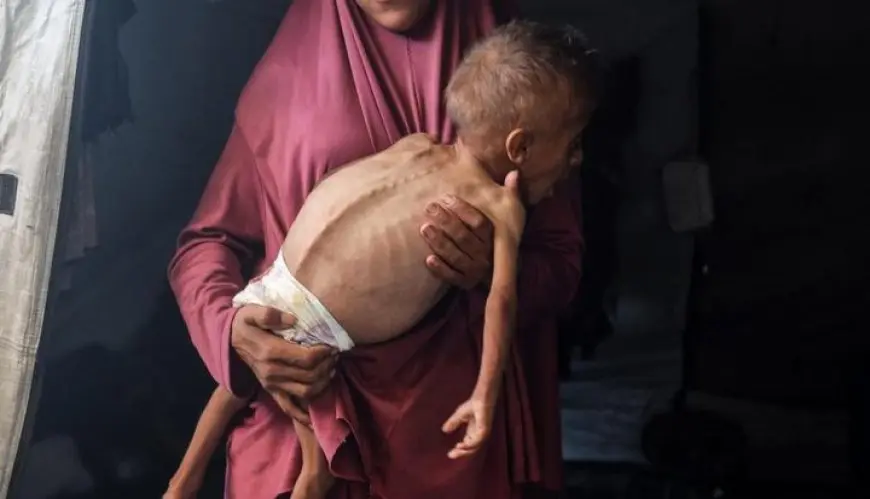شهداء الجوع في غزة.. تسجيل 8 وفيات جديدة نتيجة المجاعة وسوء التغذية