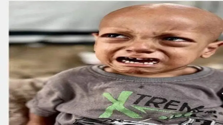 هز الضمير الإنساني.. وفاة الطفل الفلسطيني “عبد الله أبو زرقة” صاحب عبارة “أنا جعان”