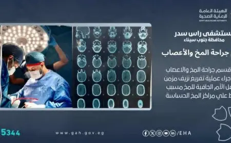 لأول مرة.. إجراء عملية بمستشفى رأس سدر لتفريغ نزيف مزمن أسفل الأم الجافية لمريض عمره 72 عاما