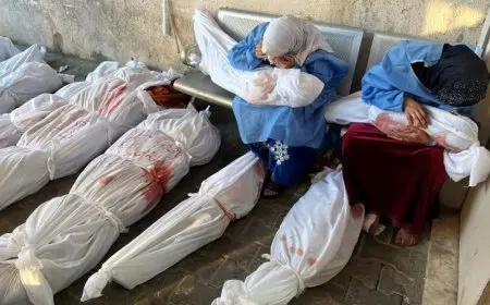 شهداء الجوع في غزة.. ارتفاع وفيات سوء التغذية إلى 367 بينهم 131 طفلا