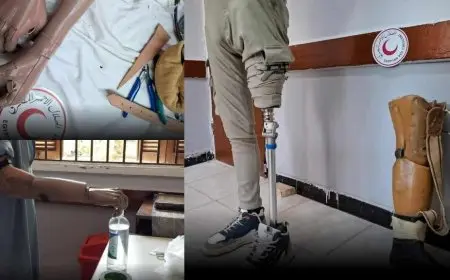 الهلال الأحمر يطلق قافلة لتركيب أطراف صناعية بالمنوفية بالتعاون مع مؤسسة أيدينا مع بعض للتأهيل