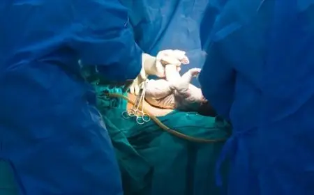 الصحة: بورسعيد وكفر الشيخ والغربية الأعلي في الولادات القيصرية غير المبررة