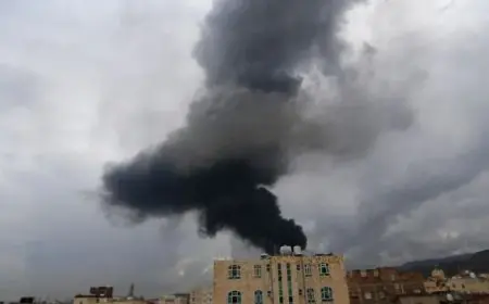 وزارة الصحة اليمنية: ارتفاع ضحايا الغارات الإسرائيلية على صنعاء إلى 183 شهيدا وجريحا