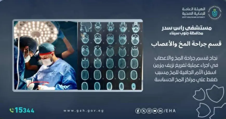 لأول مرة.. إجراء عملية بمستشفى رأس سدر لتفريغ نزيف مزمن أسفل الأم الجافية لمريض عمره 72 عاما