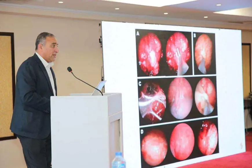 الصحة تختتم برنامجا تدريبيا لتعزيز الكشف المبكر وعلاج سرطان الرئة